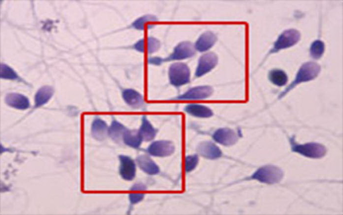 изображение сперматозоидов